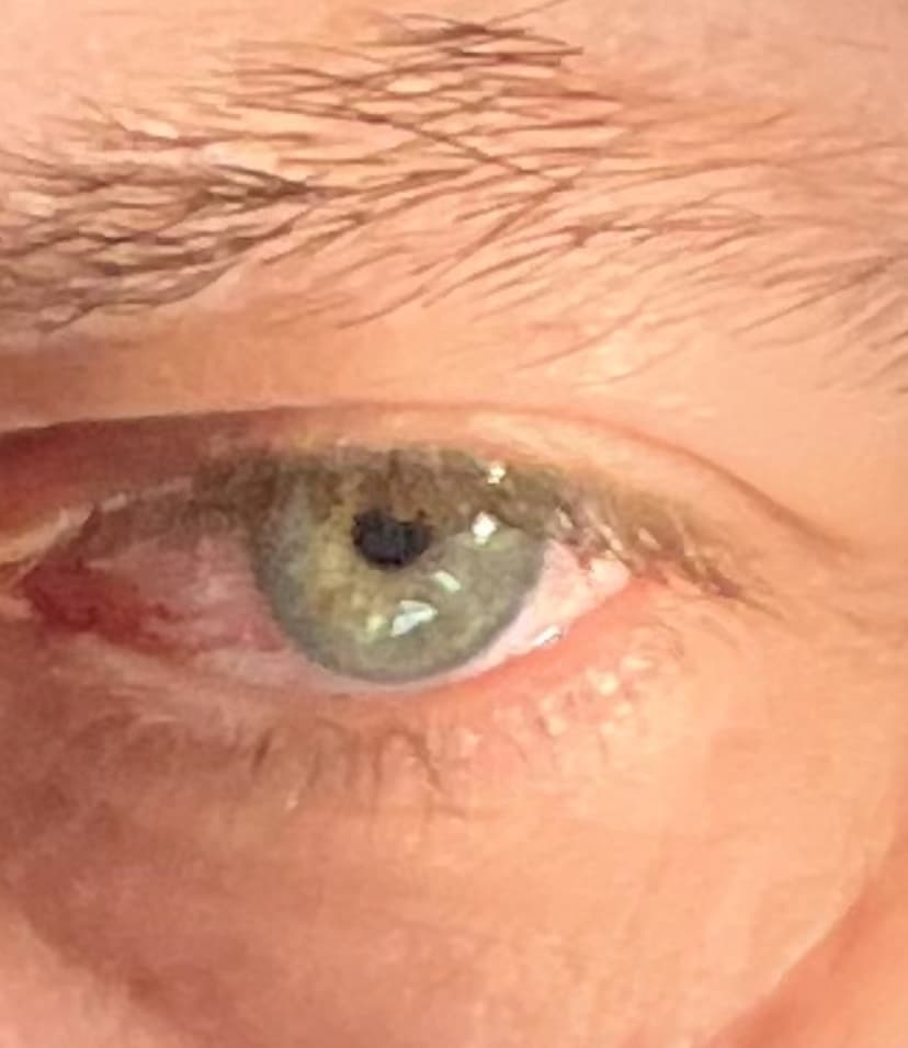 Melvyn Rencontre bdsm Waldstatt